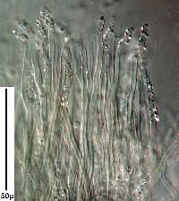 Hyphodontia radula image
