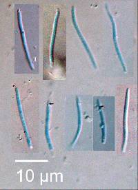 Septoria exotica image