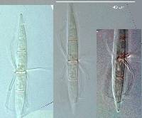 Corollospora angusta image