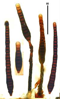 Image of Clasterosporium pedunculatum