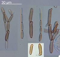 Chalastospora gossypii image