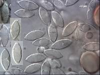 Tarzetta jafneospora image