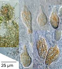 Mycosphaerella tassiana image