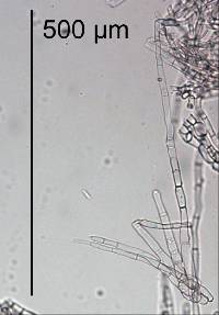 Tarzetta jafneospora image