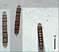 Camposporium antennatum image