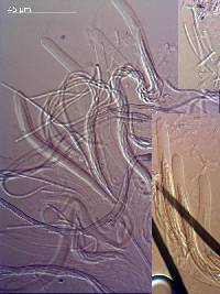 Acanthophiobolus helicosporus image