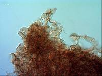 Echinoderma echinacea image