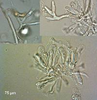 Chaetocalathus cocciformis image