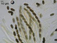 Stemphylium vesicarium image