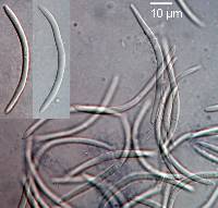 Septoria colensoi image