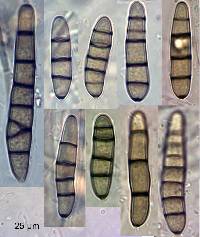 Image of Scolecobasidium salinum