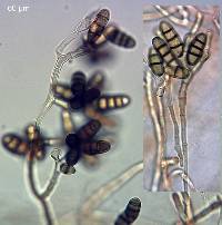 Paradendryphiella salina image