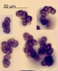 Trimmatostroma betulinum image