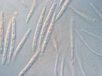 Mycogloea macrospora image