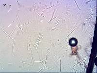 Septoria stachydis image