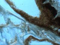 Sphaeropezia leucocheila image
