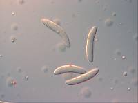 Rutstroemia macrospora f. gigaspora image