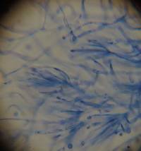 Leucogloea compressa image