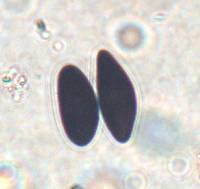 Biscogniauxia capnodes var. rumpens image