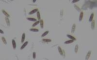 Hysterium pulicare image