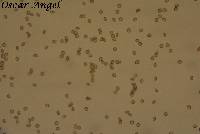 Ustilago tritici image