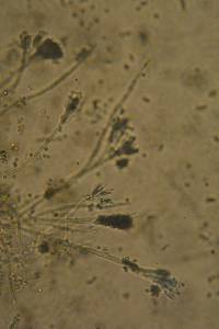 Image of Aspergillus flavus