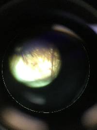 Chorioactis geaster image