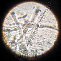 Hypomyces luteovirens image