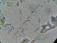 Hypomyces hyalinus image