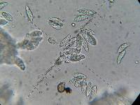 Hypomyces hyalinus image