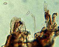 Leucoagaricus caerulescens image