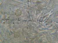 Hypomyces armeniacus image