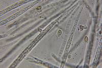 Ophiocordyceps caloceroides image