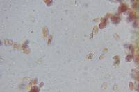 Echinoderma asperum image