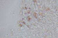 Echinoderma asperum image