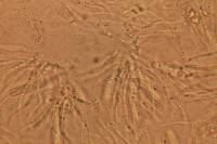 Rhytisma punctatum image