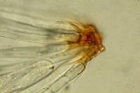 Rhizina undulata image