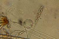 Rhizina undulata image