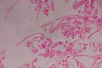 Psilocybe neoxalapensis image