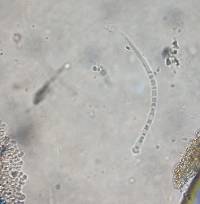 Ophiocordyceps gracilioides image