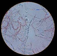 Sarcoscypha coccinea image