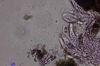 Colletotrichum coccodes image