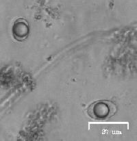 Helvella acetabulum image