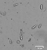 Caloplaca luteominia image