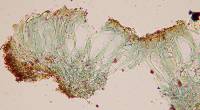 Placynthiella oligotropha image
