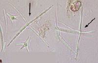 Alatospora acuminata image