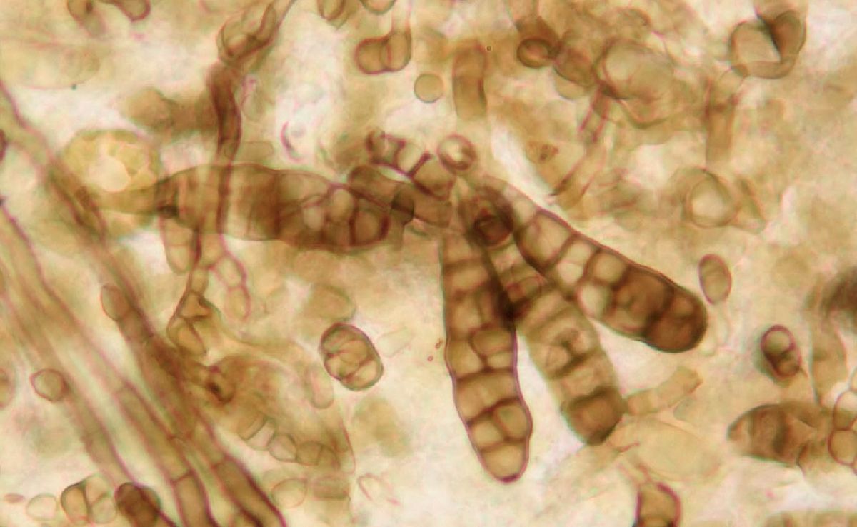 Alternaria napiformae image