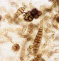 Alternaria amaranti image