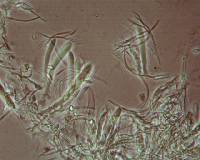 Arachnopeziza aranea image
