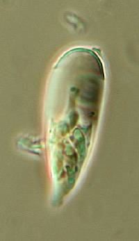 Arthonia radiata image